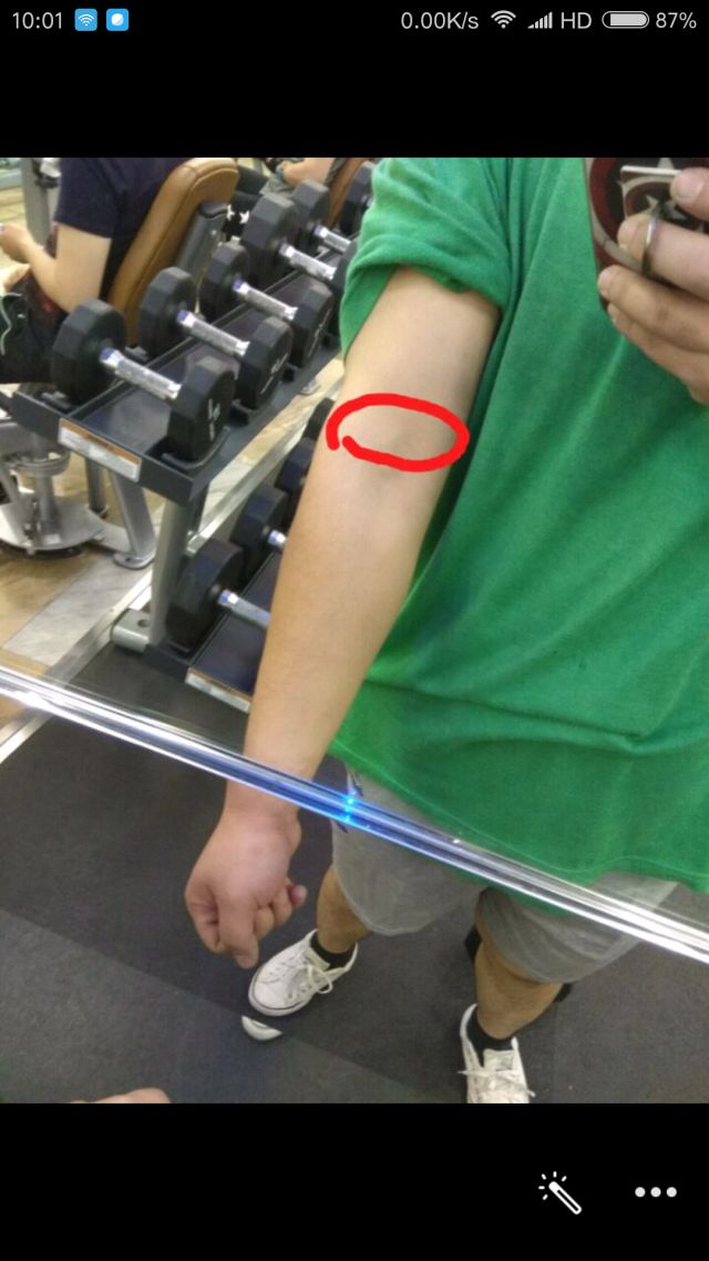 卧推时左胳膊这里疼是啥问题?