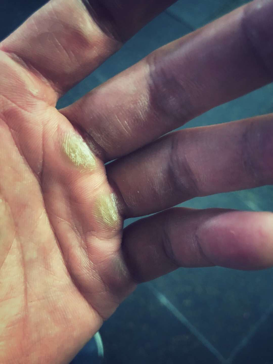 谁有去除手上老茧的教学视频?